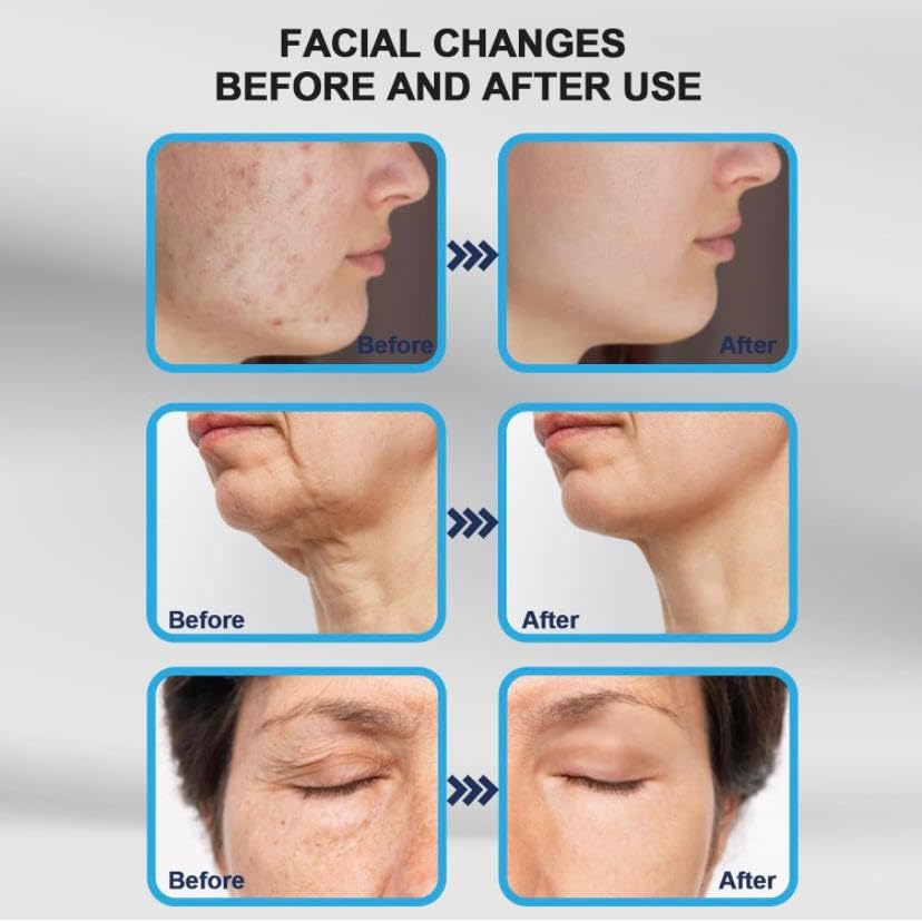 SEA5A® Derma Stamp 140A Adjustable Microneedling Stamp -Derma Microneedle Pen for Body & Hair & Beard - Skin Care - Dr Beauty Pen For Men and Women Home Use