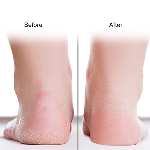 ZJchao Silicone Gel Moisturizing Socks, Foot Anti-Cracking Protector Foot Care Tool Prevention Socks Relieve Plantar Fasciitis Pain Heel Bone Spur Pain Soften Dead Skin Dry Cracked Skin (M-Skin Color)