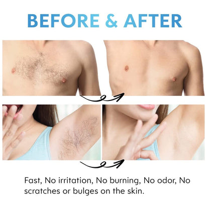 BB'Shop Crystal Hair Eraser for Women and Men, Reusable Magic Hair Eraser Crystal Hair Remover, Painless Exfoliation Hair Removal Tool for Armpits, Arms, Legs, Back (Blue)